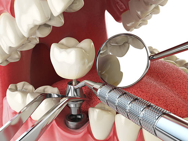 Best Walk-In Emergency Dentist in Meridian, MS