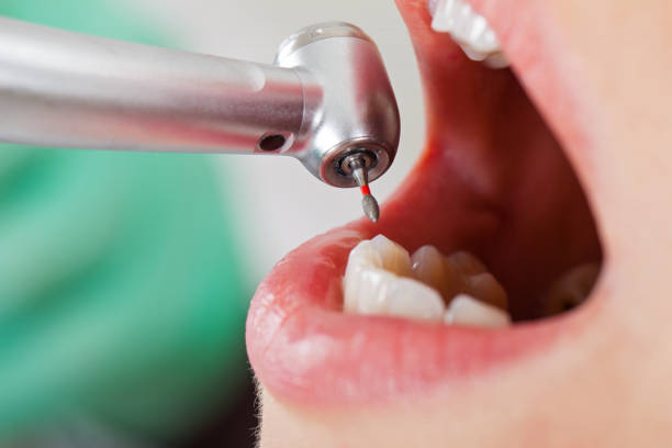 Best Pediatric Emergency Dentist in Meridian, MS